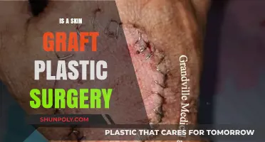 Skin Grafts vs. Plastic Surgery: Understanding the Key Differences