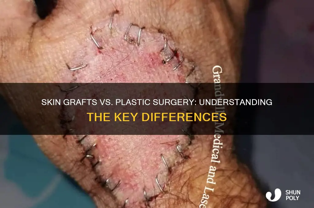 is a skin graft plastic surgery