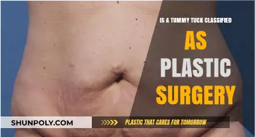 Is a Tummy Tuck Plastic Surgery? Understanding the Classification