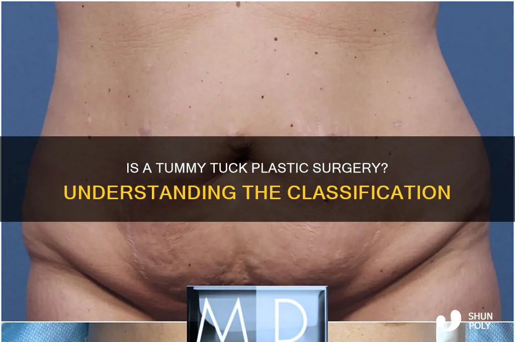 is a tummy tuck classified as plastic surgery