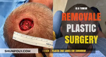Tumor Removal and Plastic Surgery: Understanding the Reconstructive Process