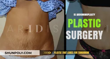 Understanding Abdominoplasty: Is It the Right Plastic Surgery for You?