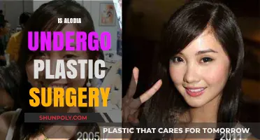 Did Alodia Gosiengfiao Undergo Plastic Surgery? Unveiling the Truth