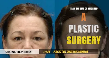Eye Lift Surgery: Understanding Its Classification in Plastic Surgery