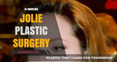Angelina Jolie Plastic Surgery: Fact-Checking Rumors and Speculations