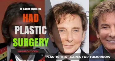 Barry Manilow's Transformation: Plastic Surgery Speculations and Truths