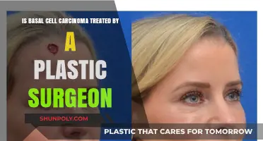 Basal Cell Carcinoma Treatment: Role of Plastic Surgeons Explained