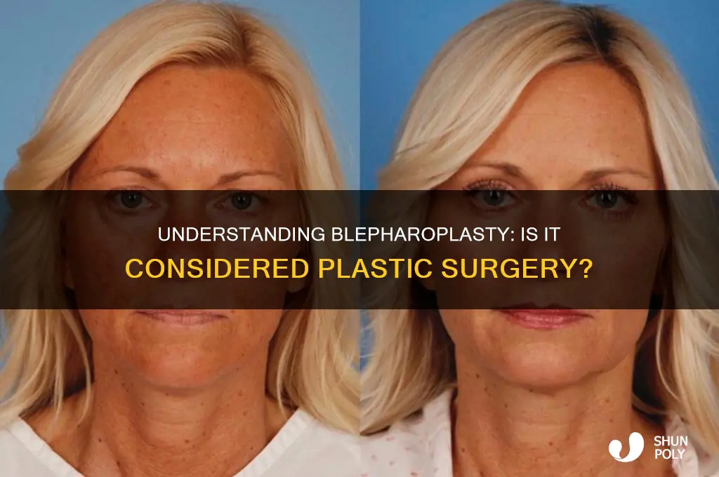 is blepharoplasty plastic surgery