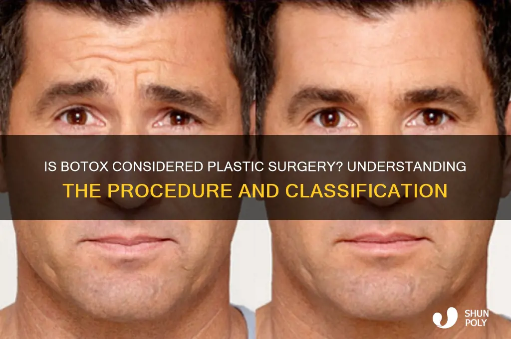 is botox a form of plastic surgery