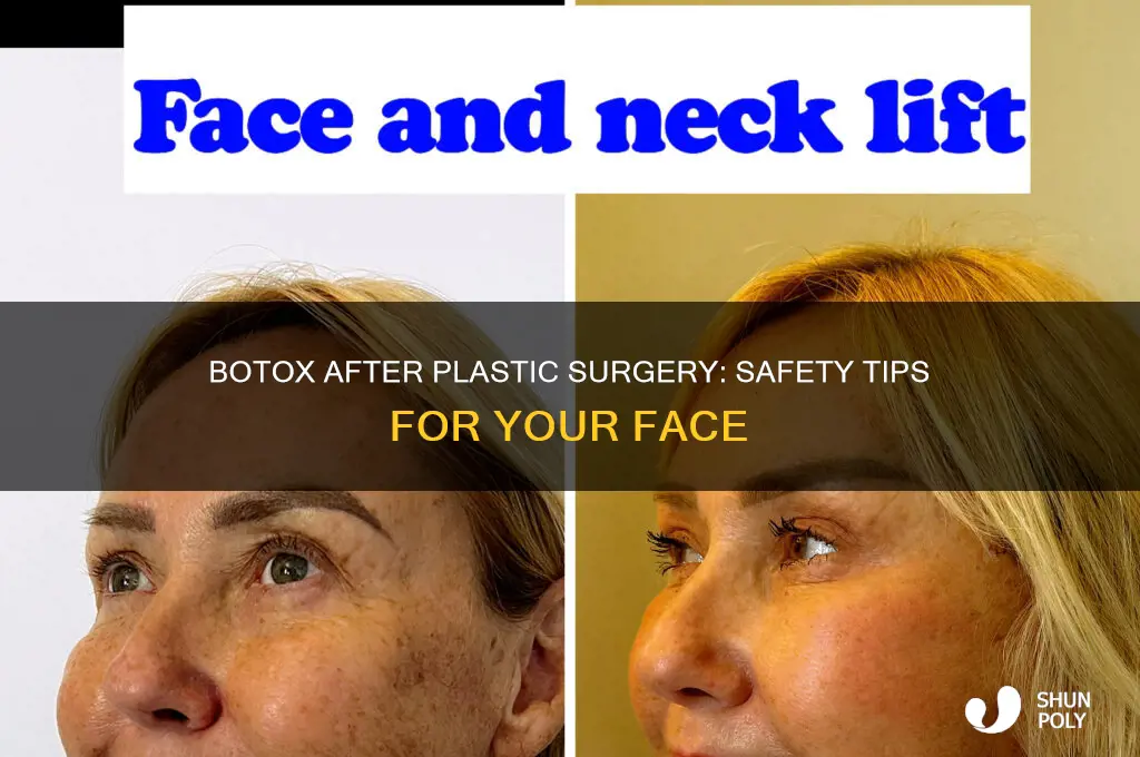 is botox safe for face that has had plastic surgery