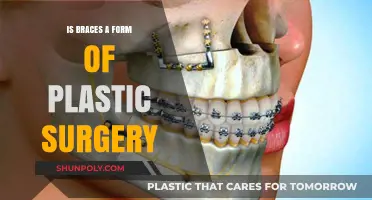 Are Braces Considered a Form of Plastic Surgery?