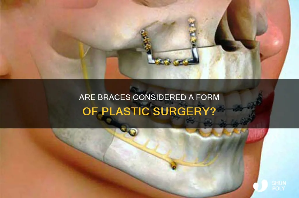 is braces a form of plastic surgery