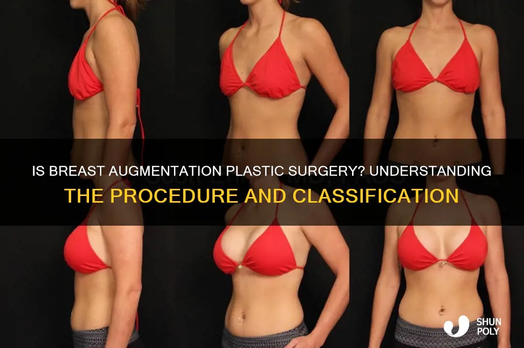 is breast augmentation considered plastic surgery
