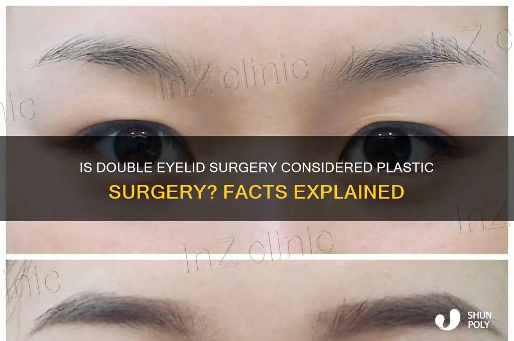 is double eyelid surgery plastic surgery