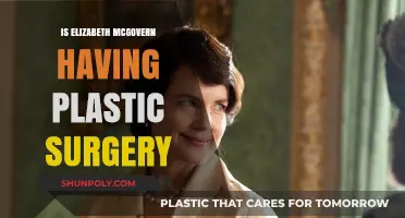 Elizabeth McGovern's Ageless Look: Plastic Surgery Speculations Explored