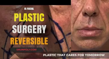 Can Facial Plastic Surgery Be Reversed? Exploring Options and Limitations