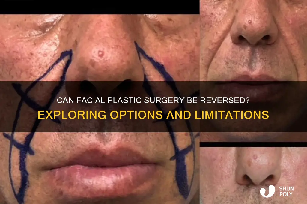is facial plastic surgery reversible