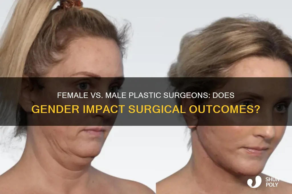 is female plastic surgeon better than male plastic surgeon