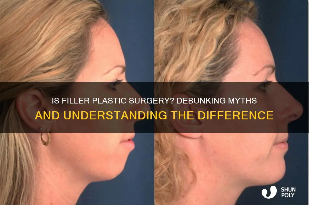 is filler considered plastic surgery