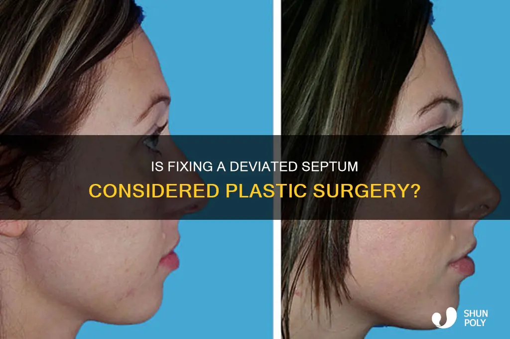 is fixing a deviated septum plastic surgery