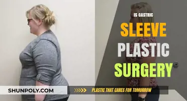 Is Gastric Sleeve a Form of Plastic Surgery? Debunking Myths