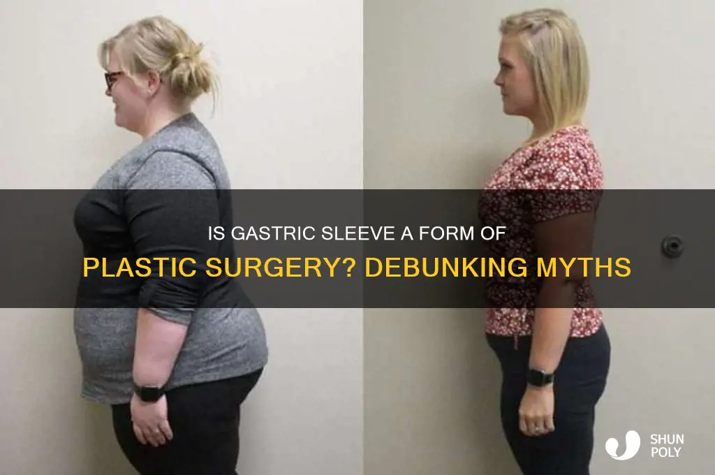 is gastric sleeve plastic surgery