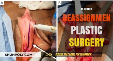 Understanding Gender Reassignment: The Role of Plastic Surgery Explained
