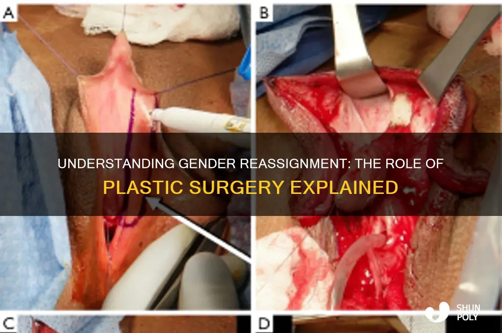 is gender reassignment plastic surgery