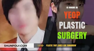 Hwang In Yeop Plastic Surgery: Fact-Checking the Rumors and Speculations