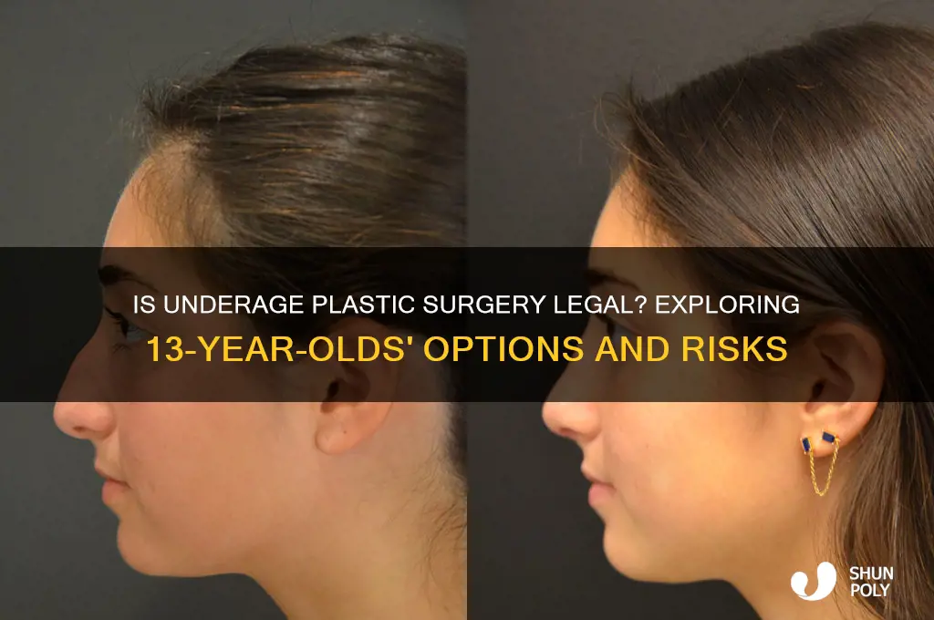 is it illegal to get plastic surgery when your 13