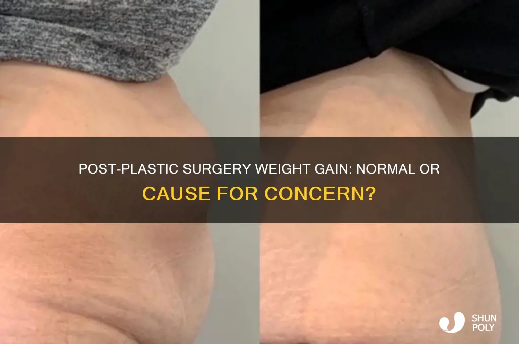 is it normal to gain weight after plastic surgery