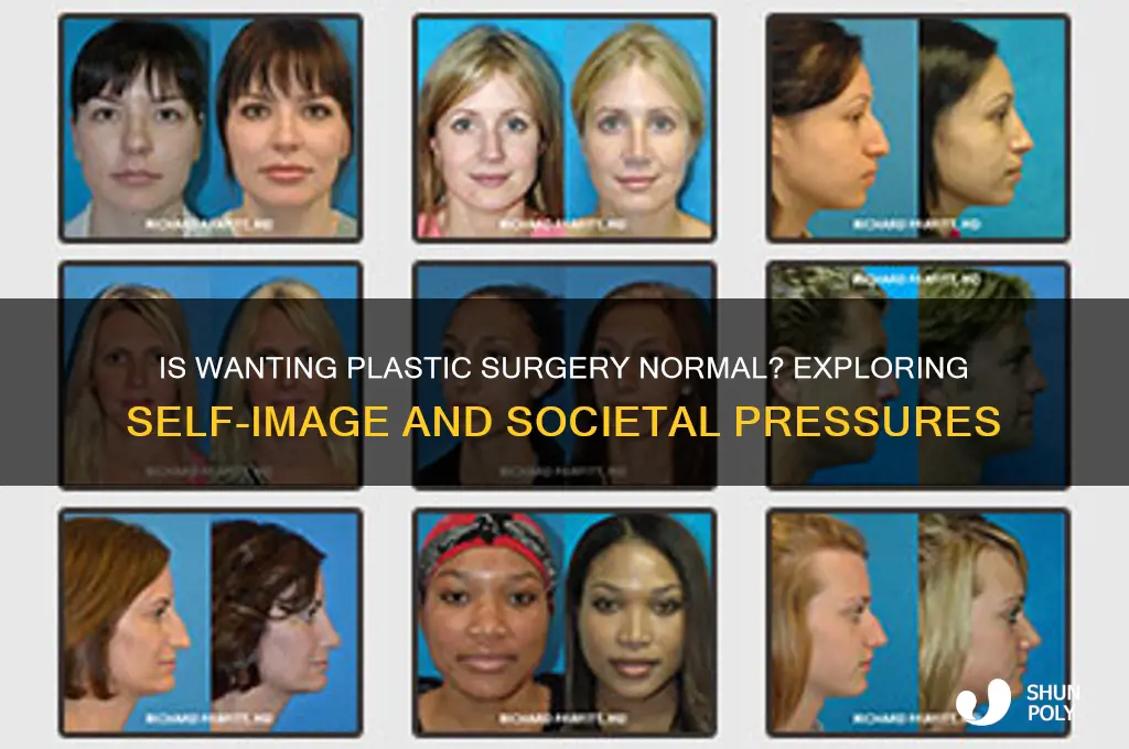 is it normal to want plastic surgery