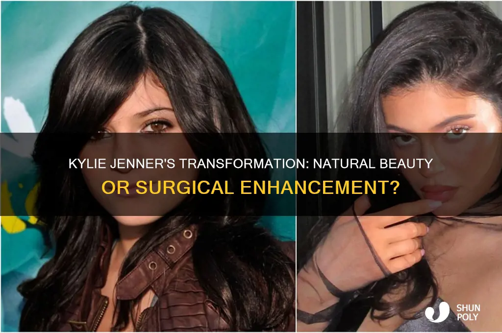 is it possible kylie jenner did not have plastic surgery