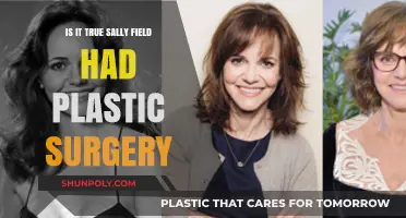 Sally Field's Transformation: Plastic Surgery Rumors Explored and Debunked