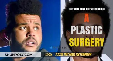 Did The Weeknd Undergo Plastic Surgery? Unraveling the Truth