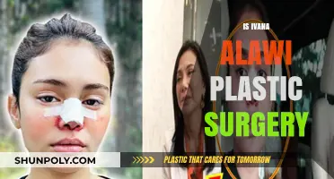 Ivana Alawi's Transformation: Unveiling the Truth About Her Plastic Surgery