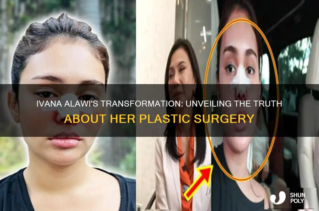 is ivana alawi plastic surgery
