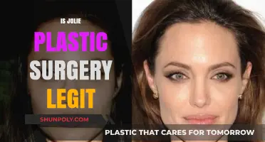 Is Jolie Plastic Surgery Legit? Uncovering the Truth Behind the Claims