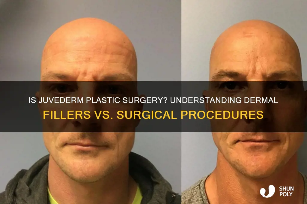 is juvederm considered plastic surgery