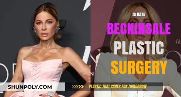 Kate Beckinsale Plastic Surgery: Fact-Checking the Rumors and Speculations