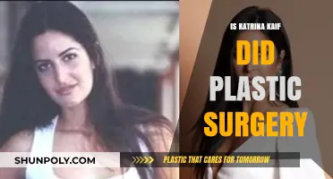 Katrina Kaif's Transformation: Plastic Surgery Rumors Explored