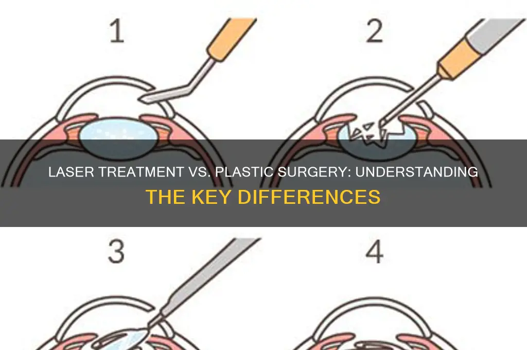 is laser treatment plastic surgery