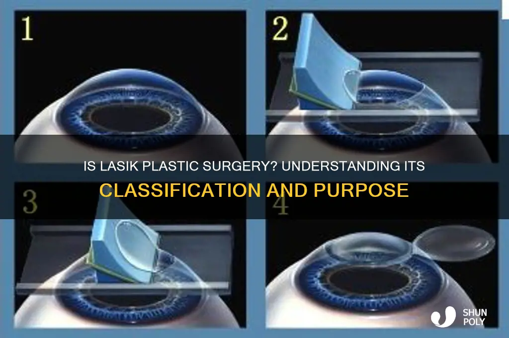 is lasik considered plastic surgery