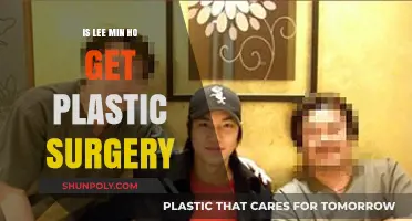 Lee Min Ho Plastic Surgery: Fact or Fiction?