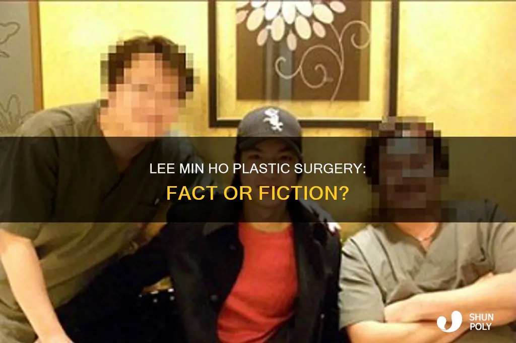 is lee min ho get plastic surgery