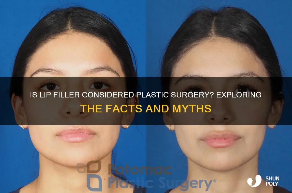 is lip filler plastic surgery