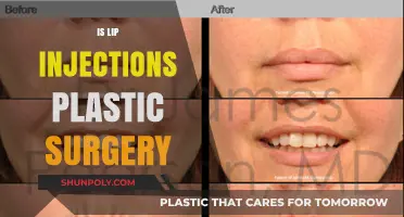 Are Lip Injections Considered Plastic Surgery? Facts and Insights