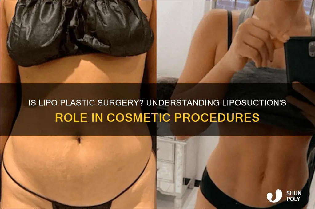 is lipo considered plastic surgery