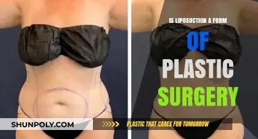 Is Liposuction Plastic Surgery? Understanding the Procedure and Classification