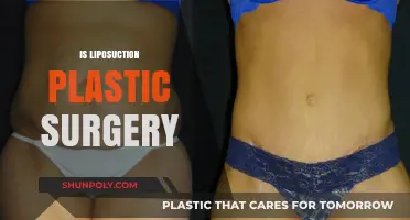 Is Liposuction Considered Plastic Surgery? Understanding the Procedure